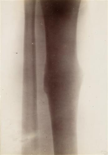 (X-RAYS) A small archive of 14 X-rays and related imagery documenting early use of the technology at Wesleyan University.